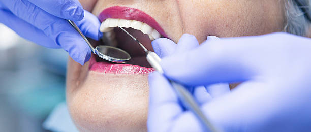 Best Emergency Wisdom Teeth Removal in Norwalk, OH